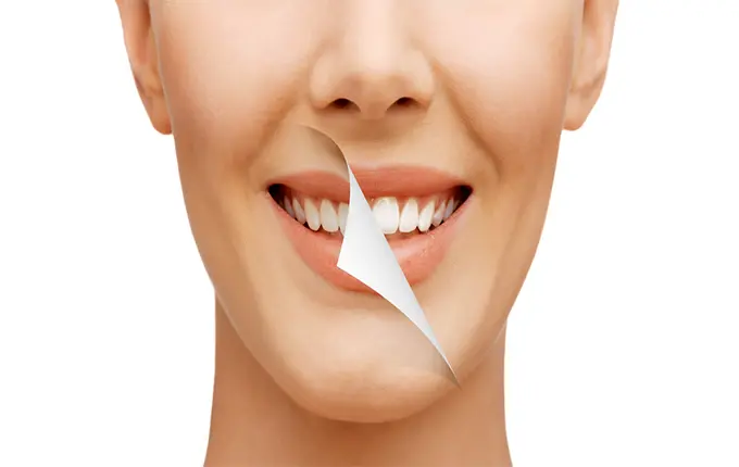 بلیچینگ بهتر است یا جرم گیری؟