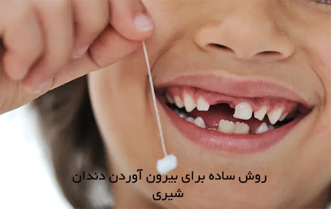 3 روش ساده برای بیرون آوردن دندان شیری
