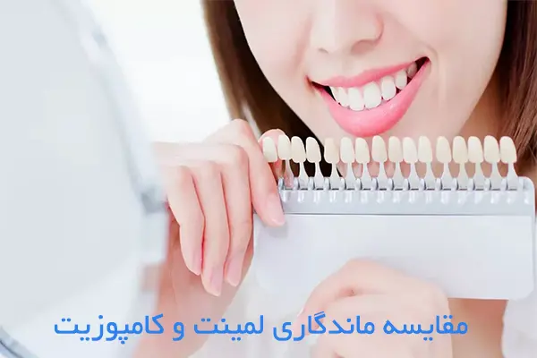 عمر لمینت بیشتر است یا کامپوزیت؟