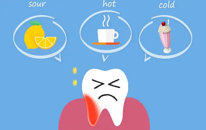 علت درد دندان بعد از پرکردن چیست؟