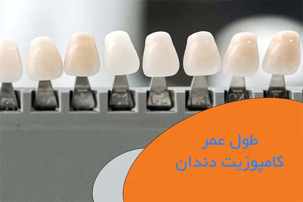 ماندگاری کامپوزیت دندان