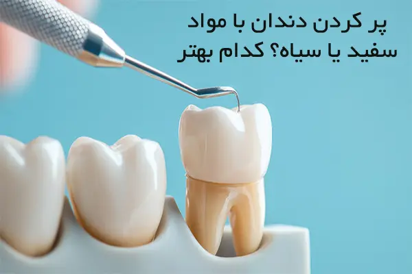 چه موادی برای پر کردن دندان خوبه؟ 