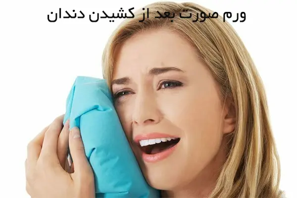 کاهش ورم صورت بعد از جراحی دندان عقل
