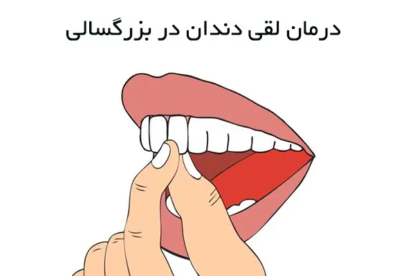 علت لق شدن دندان در بزرگسالی