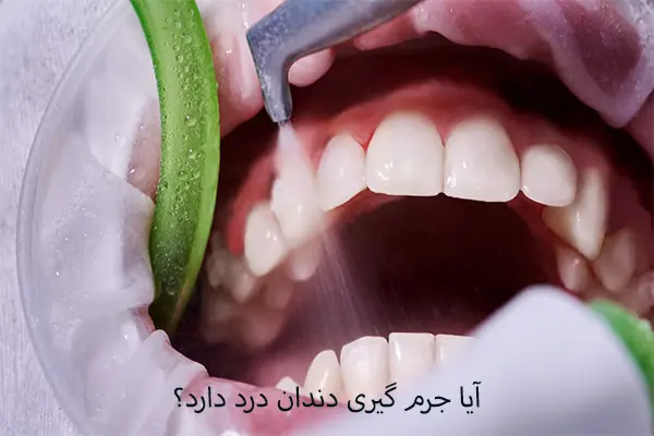آیا جرم‌ گیری دندان درد دارد؟
