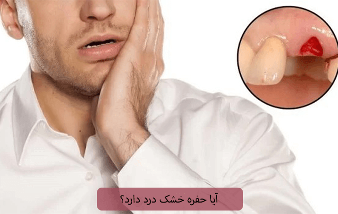 آیا حفره خشک درد دارد؟