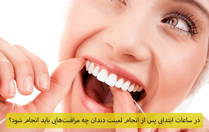 مراقبت های ساعات اولیه بعد از لمینت دندان