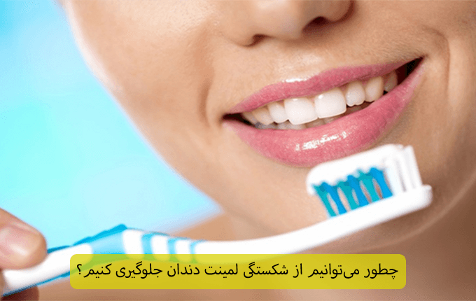چطور می‌توانیم از شکستگی لمینت دندان جلوگیری کنیم؟